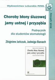 Choroby błony śluzowej jamy ustnej i przyzębia Podręcznik dla studentów stomatologii. Autor: Jańczuk Zbigniew, Banach Jadwiga. Dadada.pl Okładka książki Choroby błony śluzowej jamy ustnej i przyzębia Podręcznik dla studentów stomatologii
