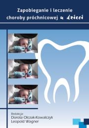 Okładka książki Zapobieganie i leczenie choroby próchnicowej u dzieci