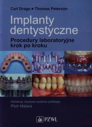 Okładka książki Implanty dentystyczne. Procedury laboratoryjne