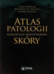 Atlas patologii złośliwych nowotworów skóry. Autor: Woźniak Leszek, Zieliński Krzysztof W., Kaszuba Andrzej. Dadada.pl Okładka książki Atlas patologii złośliwych nowotworów skóry