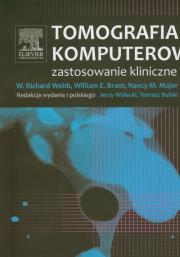Tomografia komputerowa. Autor: Webb W. Richard, Brant William E., Major Nancy M.. Dadada.pl Okładka książki Tomografia komputerowa