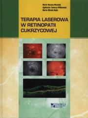 Terapia laserowa w retinopatii cukrzycowej. Autor: Muzyka-Woźniak Maria, Jamrozy-Witkowska Agnieszka, Misiuk-Hojło Marta. Dadada.pl Okładka książki Terapia laserowa w retinopatii cukrzycowej