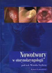 Nowotwory w otorynolaryngologii. Autor: Witolda Szyfter (red.). Dadada.pl Okładka książki Nowotwory w otorynolaryngologii