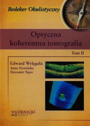 Optyczna koherentna tomografia Tom 2. Autor: Wylęgała Edward, Teper Sławomir. Dadada.pl Okładka książki Optyczna koherentna tomografia Tom 2