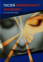 Okładka książki Toczeń rumieniowaty układowy