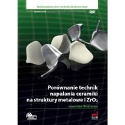 Porównanie technik napalania ceramiki na struktury metalowe i ZrO2. Wydawca: Elamed. Dadada.pl Opakowanie Porównanie technik napalania ceramiki na struktury metalowe i ZrO2