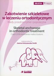 Zakotwienie szkieletowe w leczeniu ortodontycznym. Wydawca: Elamed. Dadada.pl Opakowanie Zakotwienie szkieletowe w leczeniu ortodontycznym