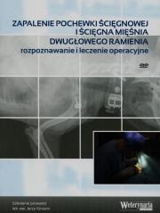 Zapalenie pochewki ścięgnowej iścięgna mięśnia dwugłowego ramienia. Autor: Jerzy Kirstein. Dadada.pl Okładka książki Zapalenie pochewki ścięgnowej iścięgna mięśnia dwugłowego ramienia