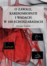 Okładka książki O zawale kardiomiopatii i wadach w 100 echoszaradach
