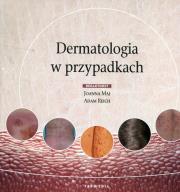Okładka książki Dermatologia w przypadkach