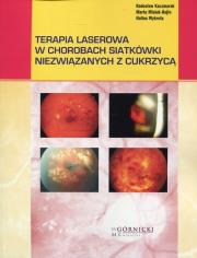 Terapia laserowa w chorobach siatkówki niezwiązanych z cukrzycą. Autor: Kaczmarek Radosław, Misiuk-Hojło Marta, Wykrota Halina. Dadada.pl Okładka książki Terapia laserowa w chorobach siatkówki niezwiązanych z cukrzycą