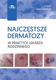 Okładka książki Najczęstsze dermatozy w praktyce lekarza rodzinnego