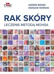 Okładka książki Rak skóry Leczenie metodą Mohsa