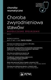 Okładka książki Choroba zwyrodnieniowa stawów