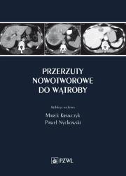 Okładka książki Przerzuty nowotworowe do wątroby