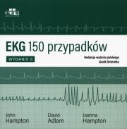 Okładka książki EKG 150 przypadków