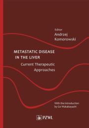 Okładka książki Metastatic Disease in the Liver - Current Therapeutic Approaches