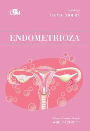 Okładka książki Endometrioza