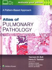 Atlas of Pulmonary Pathology. Autor: Mahmood Butt Yasmeen, Tazelaar Henry D.. Dadada.pl Okładka książki Atlas of Pulmonary Pathology