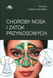 Okładka książki Choroby nosa i zatok przynosowych