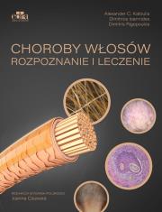 Okładka książki Choroby włosów. Rozpoznanie i leczenie
