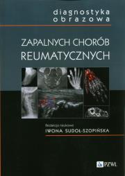 Diagnostyka obrazowa zapalnych chorób reumatycznych. Autor:   Praca zbiorowa. Dadada.pl Okładka książki Diagnostyka obrazowa zapalnych chorób reumatycznych