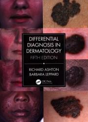 Okładka książki Differential Diagnosis in Dermatology