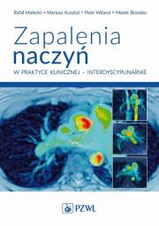 Okładka książki Zapalenia naczyń w praktyce klinicznej interdyscyplinarnie