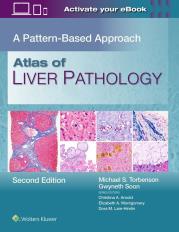 Okładka książki Atlas of Liver Pathology