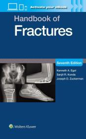 Okładka książki Handbook of Fractures: Print + eBook with Multimedia