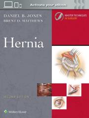 Okładka książki Master Techniques in Surgery: Hernia: Print + eBook with Multimedia