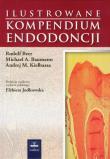 Ilustrowane kompendium endodoncji. Autor: Beer Rudolf, Baumann Michael A., Kielbassa Andriej M.. Dadada.pl Okładka książki Ilustrowane kompendium endodoncji