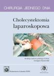 Opakowanie Chirurgia jednego dnia Cholecystektomia laparoskopowa