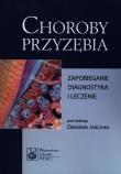 Choroby przyzębia. Zapobieganie, diagnostyka.... Autor: Banach Jadwiga, Elżbieta Dembowska, Jańczuk Zbigniew. Dadada.pl Okładka książki Choroby przyzębia. Zapobieganie, diagnostyka...
