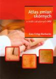 Atlas zmian skórnych u osób zakażonych HIV. Autor: Firląg-Burkacka Ewa. Dadada.pl Okładka książki Atlas zmian skórnych u osób zakażonych HIV