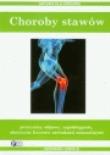 Okładka książki Choroby stawów. Natura dla zdrowia
