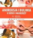 Okładka książki Anoreksja i bulimia u dzieci i młodzieży