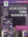 Okładka książki Alloplastyka stawu biodrowego z płytą DVD