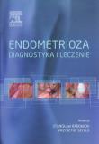 Opakowanie Endometrioza diagnostyka i leczenie