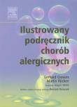 Ilustrowany podręcznik chorób alergicznych. Autor: Grevers Gerhard. Dadada.pl Okładka książki Ilustrowany podręcznik chorób alergicznych