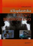 Alloplastyka stawu biodrowego. Autor: Pozowski Andrzej. Dadada.pl Okładka książki Alloplastyka stawu biodrowego