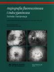 Angiografia fluoresceinowa i indocyjaninowa. Autor: Berkow Joseph W., Flower Robert W., Orth David H., Kelley James S.. Dadada.pl Okładka książki Angiografia fluoresceinowa i indocyjaninowa