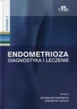 Okładka książki Endometrioza Diagnostyka i leczenie