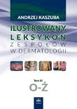 Ilustrowany leksykon zespołów w dermatologii Tom 3 O-Ż. Autor: Kaszuba Andrzej. Dadada.pl Okładka książki Ilustrowany leksykon zespołów w dermatologii Tom 3 O-Ż