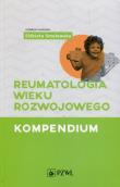 Reumatologia wieku rozwojowego Kompendium. Autor: Elżbieta Smolewska. Dadada.pl Okładka książki Reumatologia wieku rozwojowego Kompendium