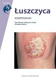 Okładka książki Łuszczyca. Kompendium