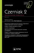 Czerniak. Współczesne podejście 2. Autor: Rutkowski Piotr. Dadada.pl Okładka książki Czerniak. Współczesne podejście 2