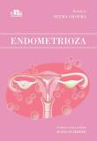 Okładka książki Endometrioza