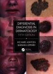 Differential Diagnosis in Dermatology. Autor: Ashton Richard, Leppard Barbara. Dadada.pl Okładka książki Differential Diagnosis in Dermatology