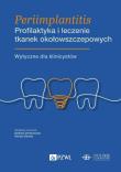 Periimplantitis. Profilaktyka i leczenie tkanek okołowszczepowych. Autor: Elżbieta Dembowska, Górska Renata. Dadada.pl Okładka książki Periimplantitis. Profilaktyka i leczenie tkanek okołowszczepowych